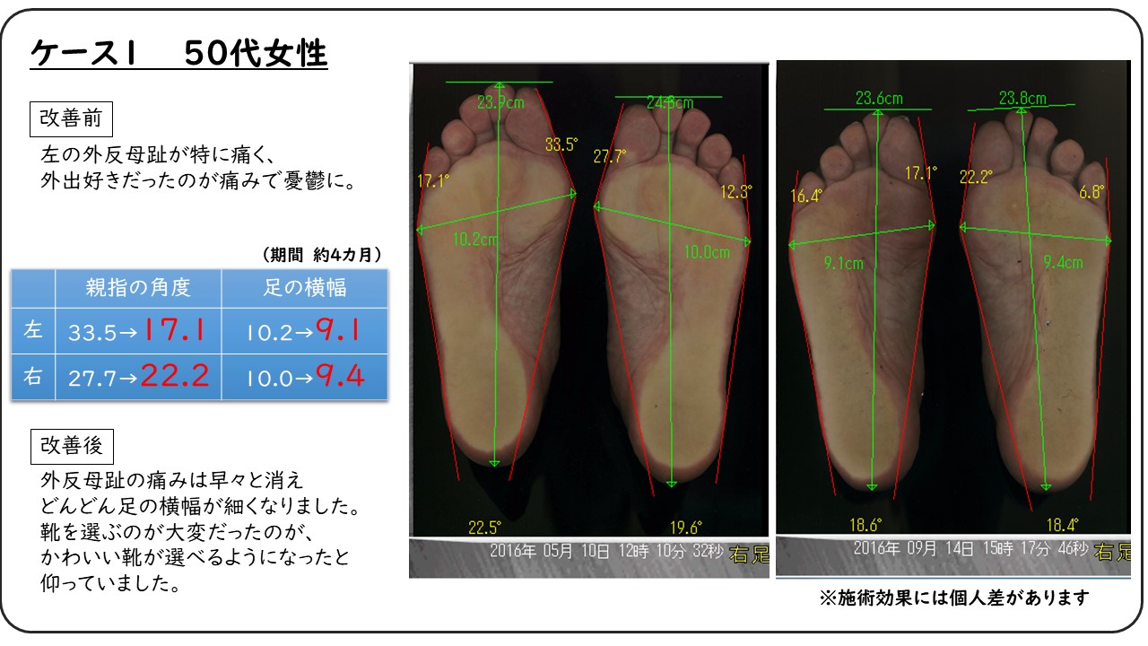 フットケア町田